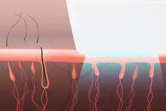 Laser hair removal household whole body photon